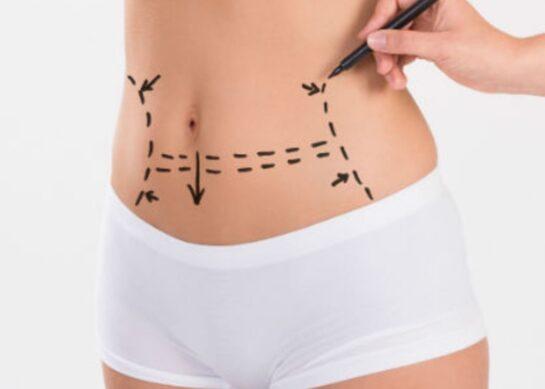 La Chirurgie esthétique du ventre : détails et photos