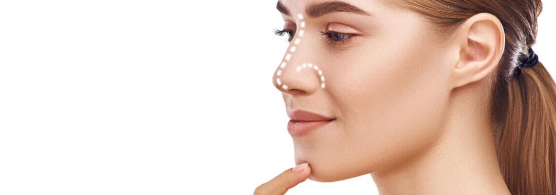 Rhinoplastie : la convalescence semaine par semaine