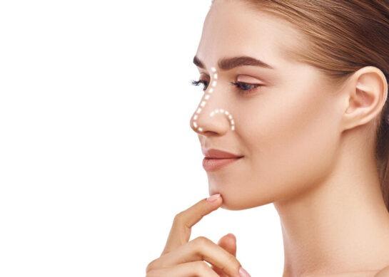 Rhinoplastie : la convalescence semaine par semaine