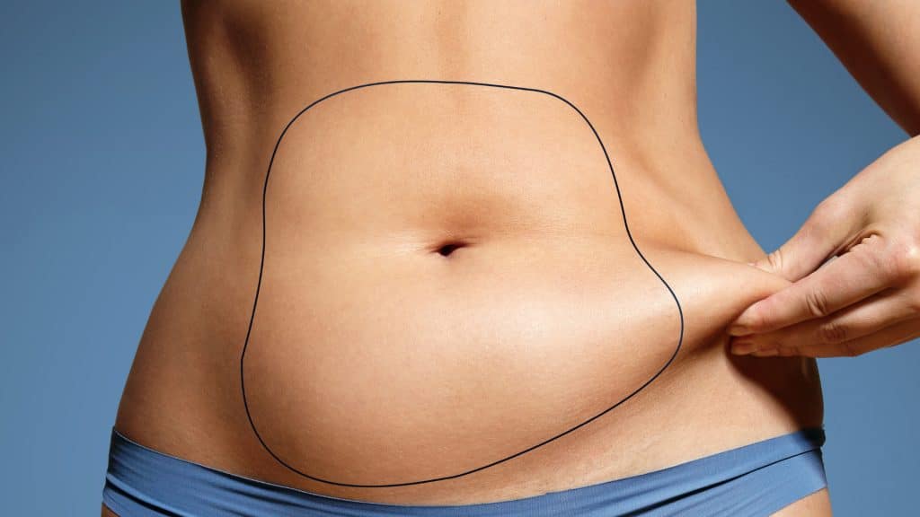 Comment retendre la peau du ventre après liposuccion ?