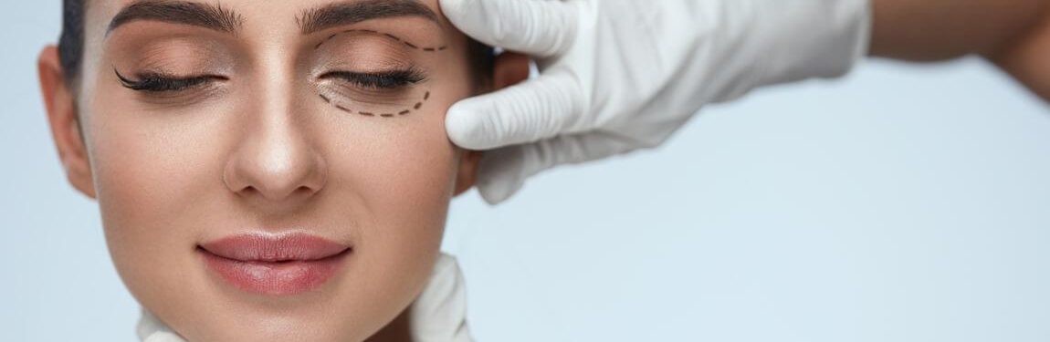 Blepharoplastie