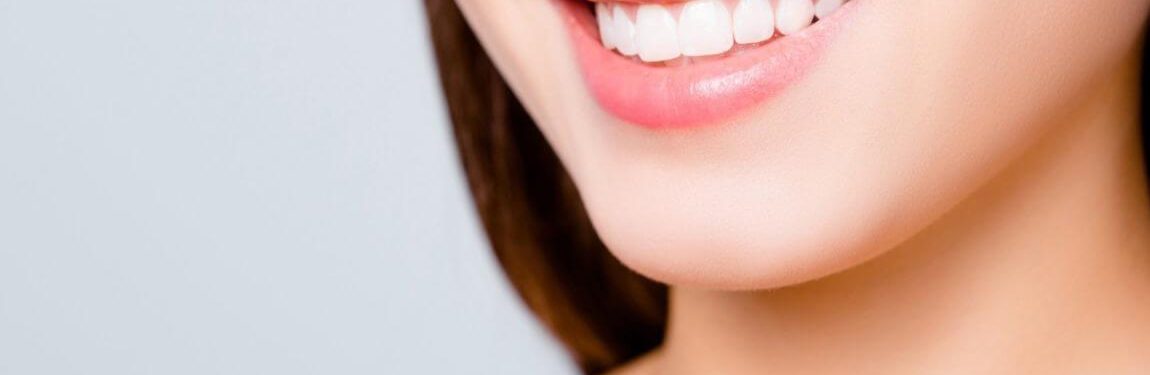 Gingivectomie1