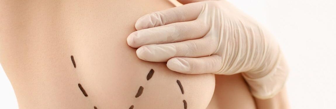 Lipofilling des seins